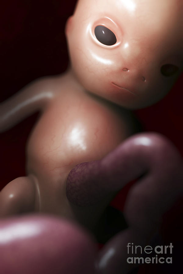 Developing Fetus Week10 #5 Photograph by Science Picture Co