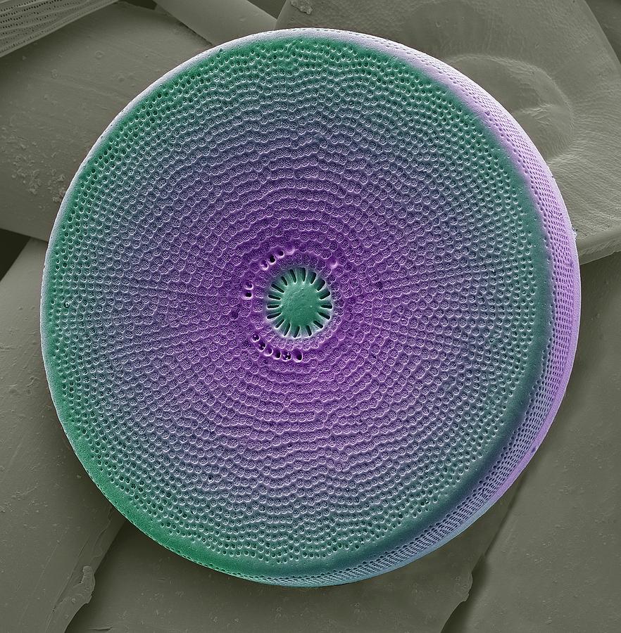 Nature Photograph - Diatom #5 by Steve Gschmeissner