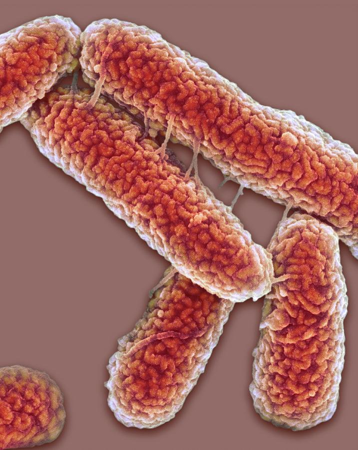 Escherichia Coli Photograph - E. Coli Bacteria #5 by Science Photo Library