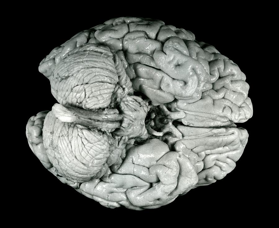 Einsteins Brain #5 Photograph by Otis Historical Archives, National Museum Of Health And Medicine