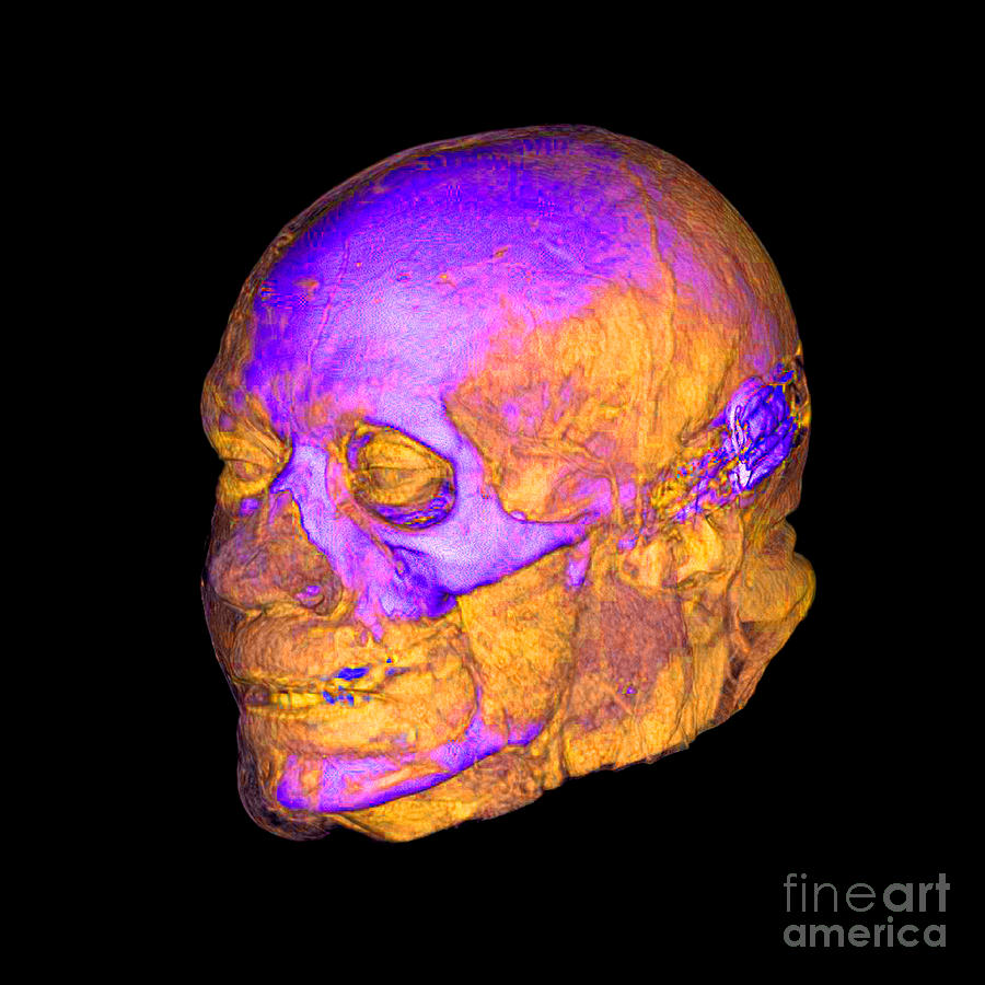 Enhanced 3d Ct Of Face And Skull #5 Photograph by Living Art Enterprises