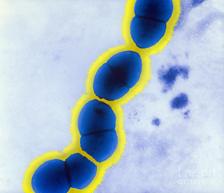 Science Photograph - Enterococcus Faecalis, Tem #5 by Kwangshin Kim