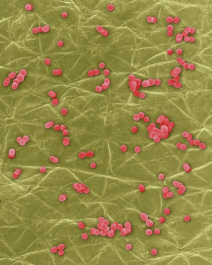 Enterococcus Faecium On Human Skin Photograph By Dennis Kunkel Microscopyscience Photo Library 9889