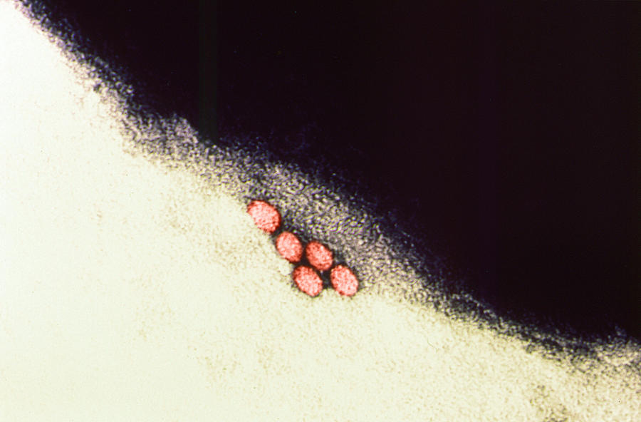 Enterovirus, Tem Photograph by Science Source | Fine Art America