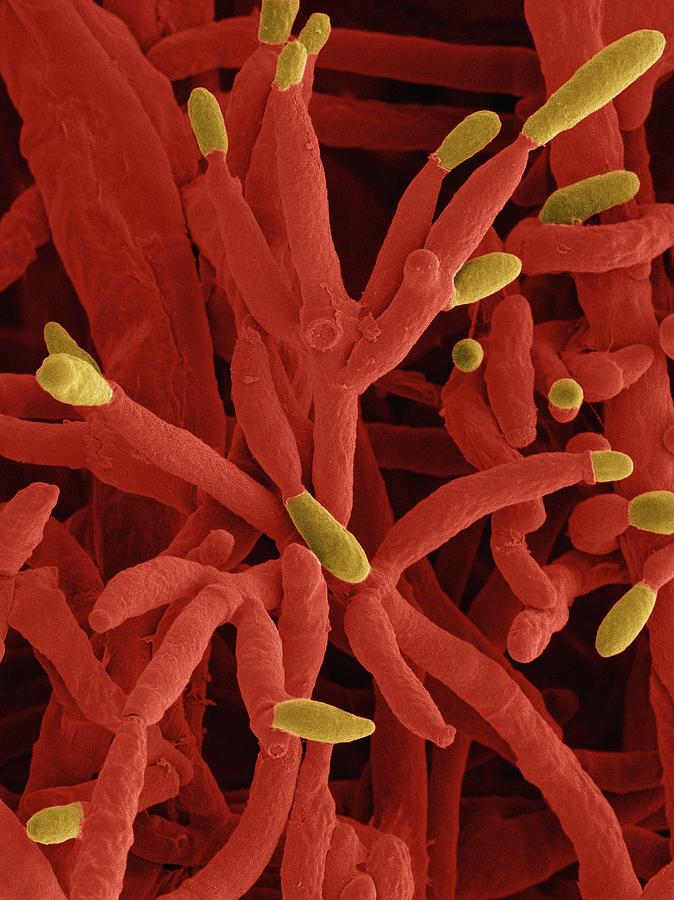 Fusarium Incarnatum Pathogenic Fungus #5 Photograph by Dennis Kunkel Microscopy/science Photo Library