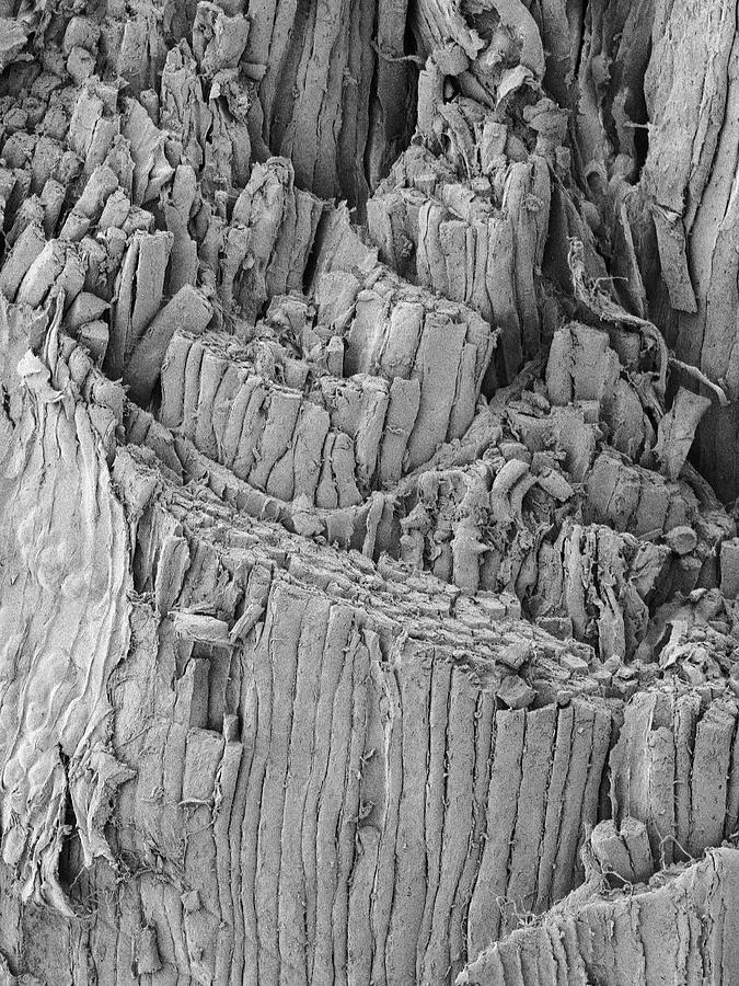 Ham Shank Muscle Fibres #5 Photograph by Dennis Kunkel Microscopy/science Photo Library