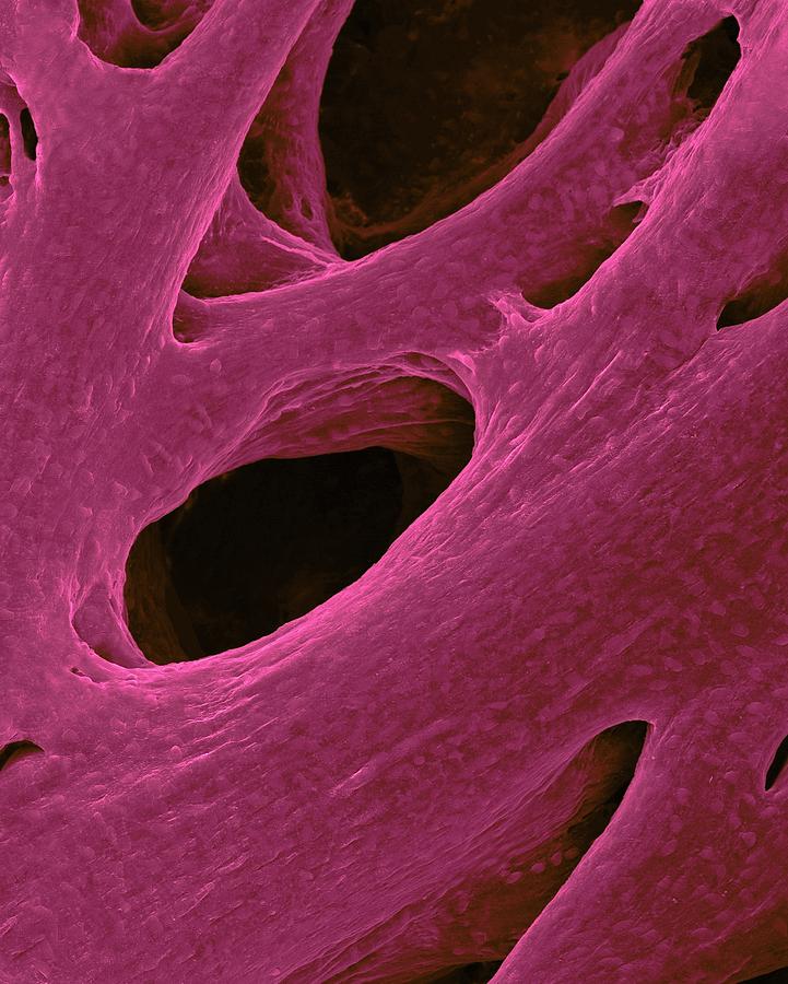 Heart Atrium Muscle Fibres #5 Photograph by Dennis Kunkel Microscopy/science Photo Library