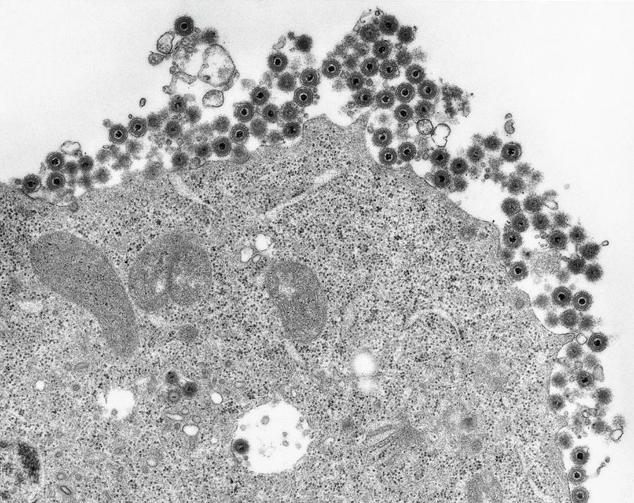 Herpes Simplex Virus #5 Photograph by Dennis Kunkel Microscopy/science Photo Library