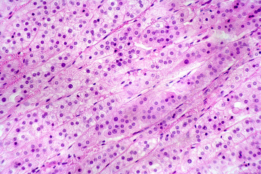 Human Adrenal Gland Section Lm Photograph By Science Stock Photography