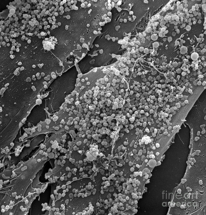 Human Skin Cell Sem #5 Photograph by David M. Phillips