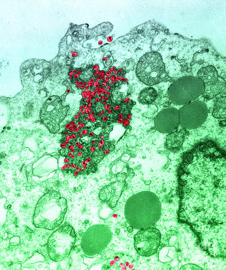 Tem Photograph - Human T-lymphocyte Showing Hiv #5 by Kwangshin Kim