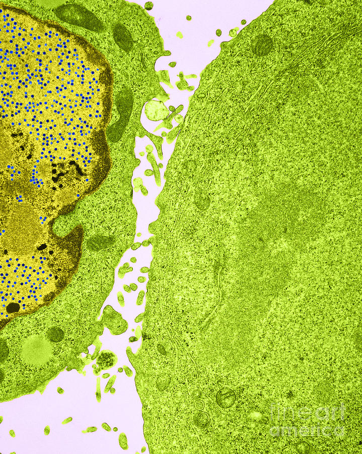 Kb Cell Infected With Adenovirus Tem #5 Photograph by David M. Phillips