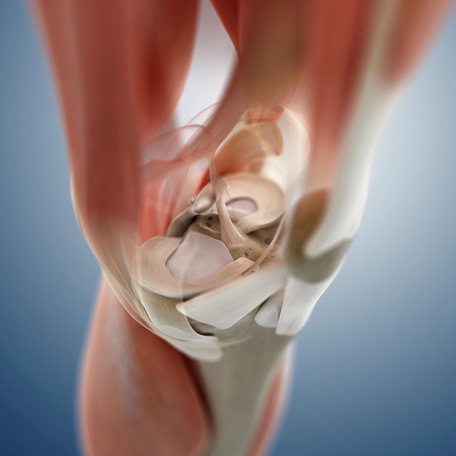 Knee Anatomy #5 Photograph by Springer Medizin/science Photo Library