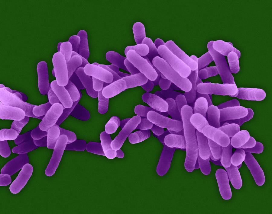 Legionella Pneumophila Photograph By Dennis Kunkel Microscopyscience Photo Library Pixels 3293