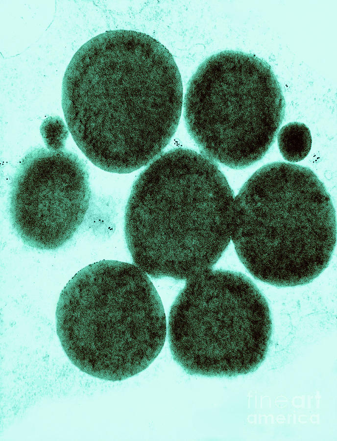 Lipid Droplets Tem #5 Photograph by David M. Phillips