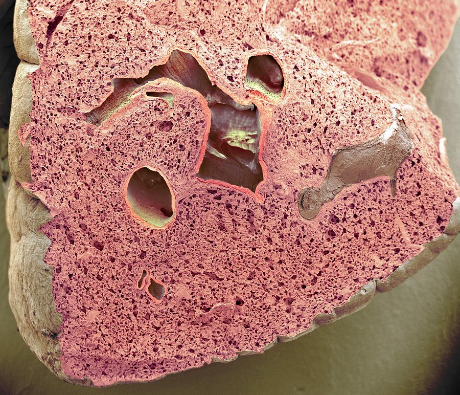 Lung Tissue #5 Photograph by Steve Gschmeissner/science Photo Library