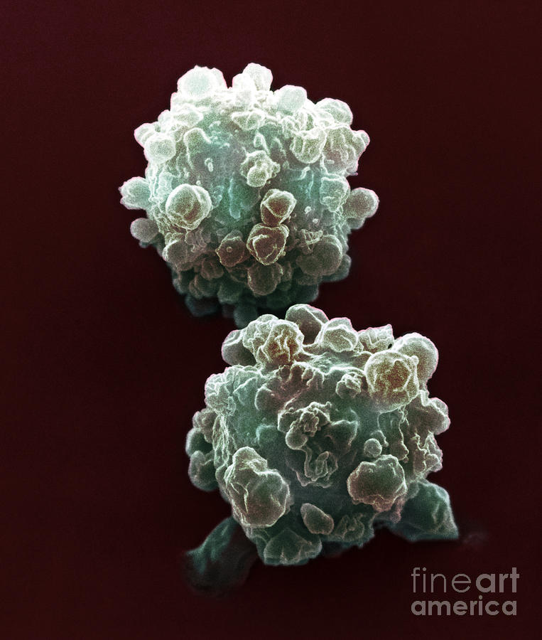 Lymphocytes Undergoing Apoptosis, Sem #5 Photograph by David M. Phillips