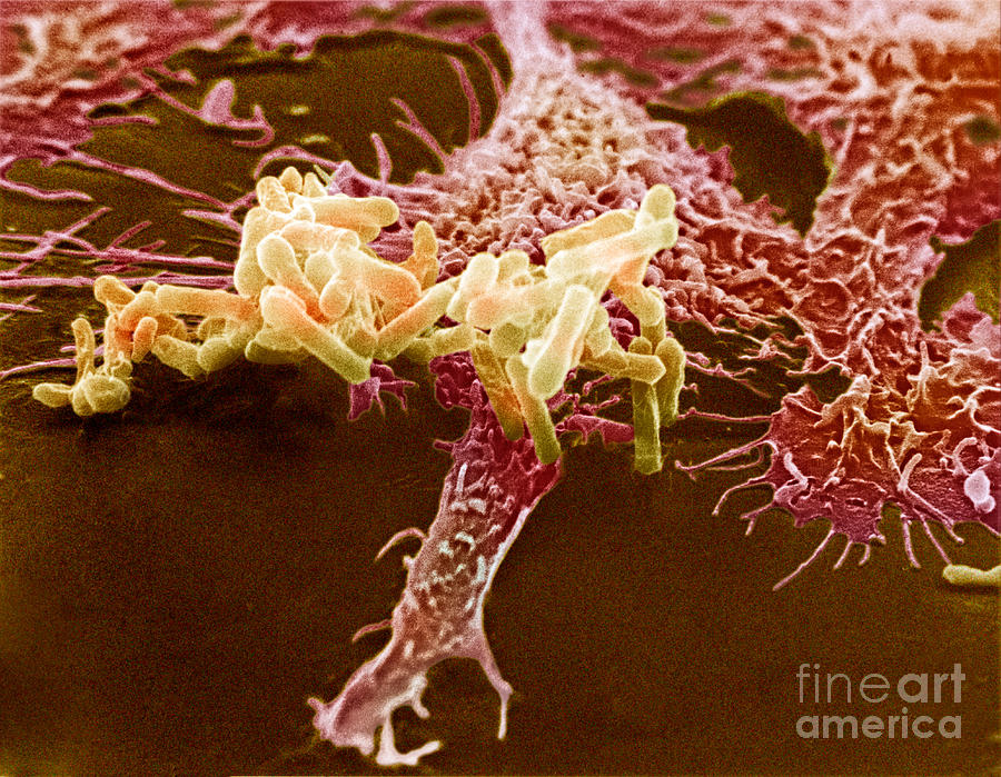Macrophage Ingesting Pseudomonas #5 Photograph by David M. Phillips