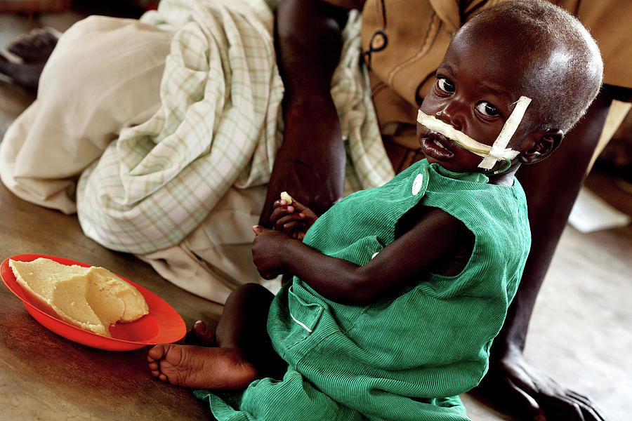 Malnourished Child Being Fed Photograph by Mauro Fermariello/science ...