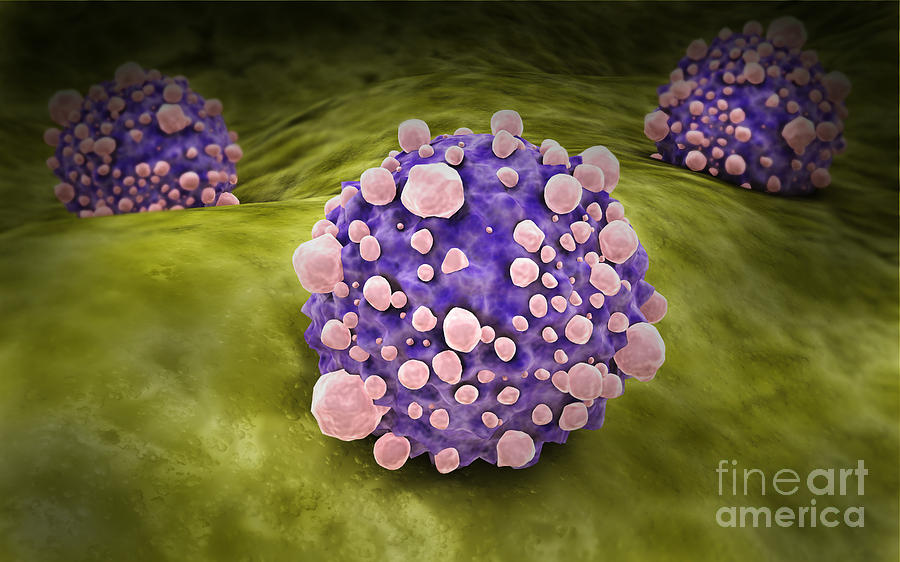 Microscipic View Of Pancreatic Cancer Digital Art