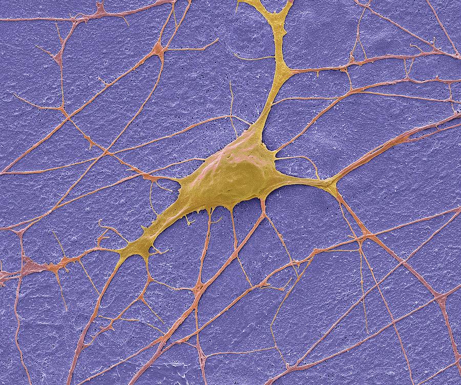 Motor Neurone #5 Photograph by Steve Gschmeissner