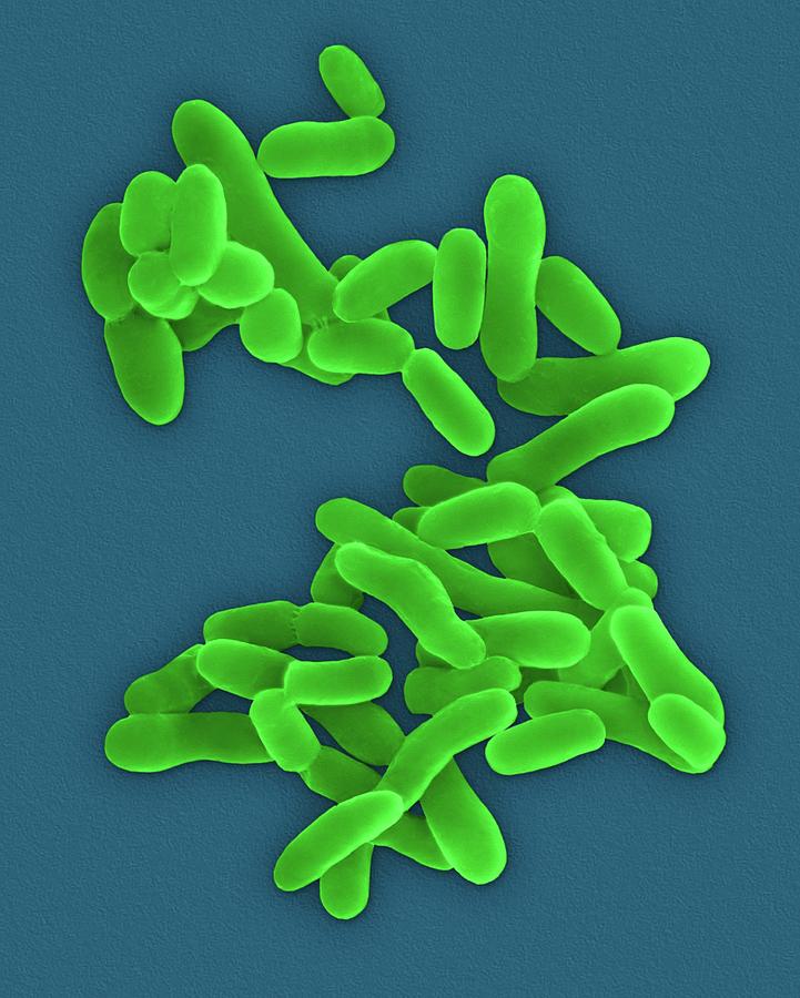 Mycobacterium Tuberculosis Photograph by Dennis Kunkel Microscopy ...