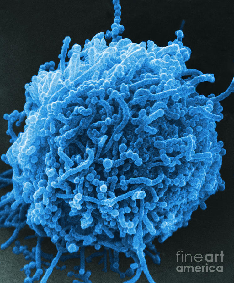 Bacterial Photograph - Mycoplasma Bacteria, Sem #5 by David M. Phillips
