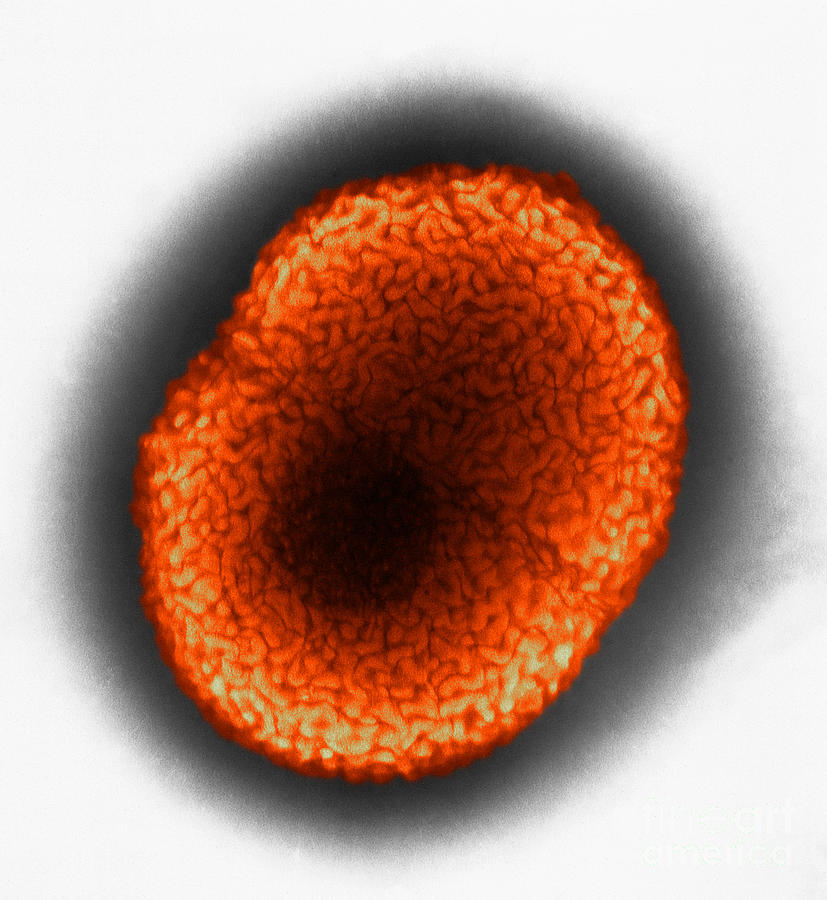 Neisseria Gonorrhoeae, Tem #5 Photograph by Kwangshin Kim