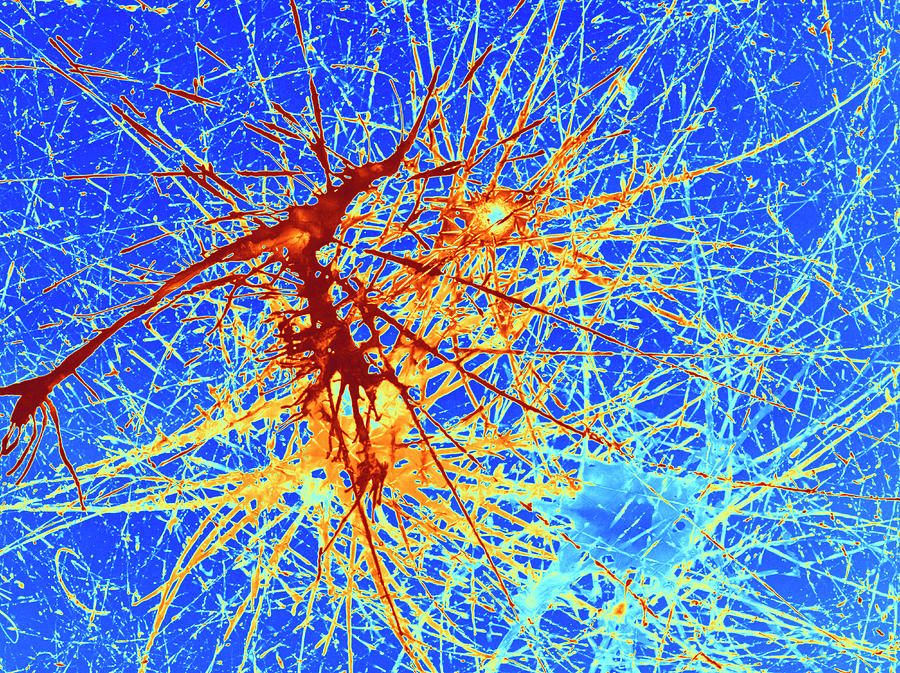 Nerve Cells #5 Photograph by Pasieka