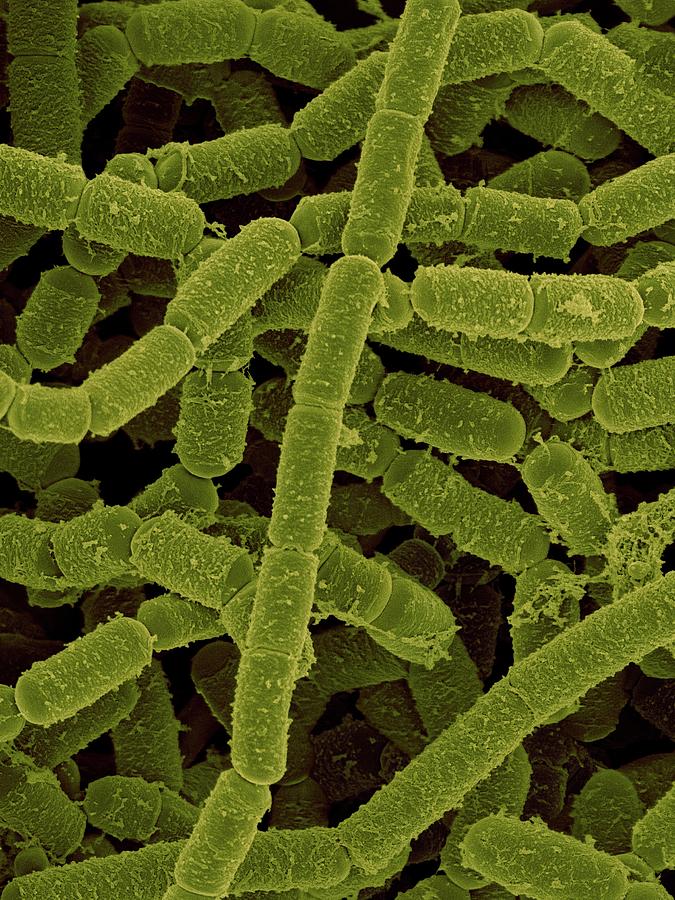 Paenibacillus Amylolyticus #5 Photograph by Dennis Kunkel Microscopy/science Photo Library