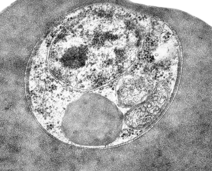 Plasmodium Falciparum #5 Photograph by Dennis Kunkel Microscopy/science Photo Library