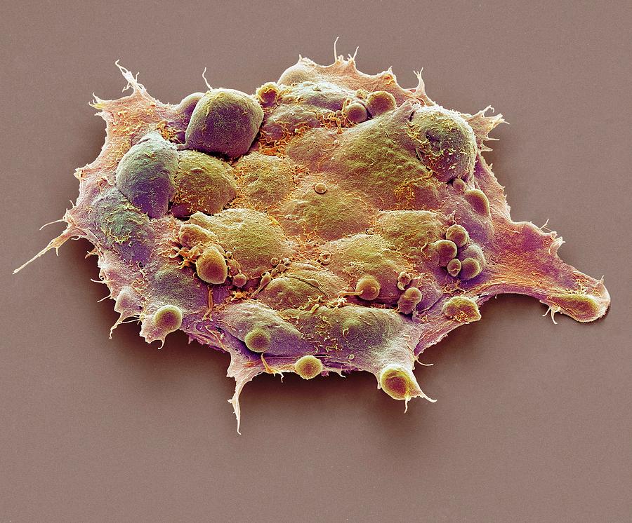 Pluripotent Stem Cells #5 Photograph by Steve Gschmeissner