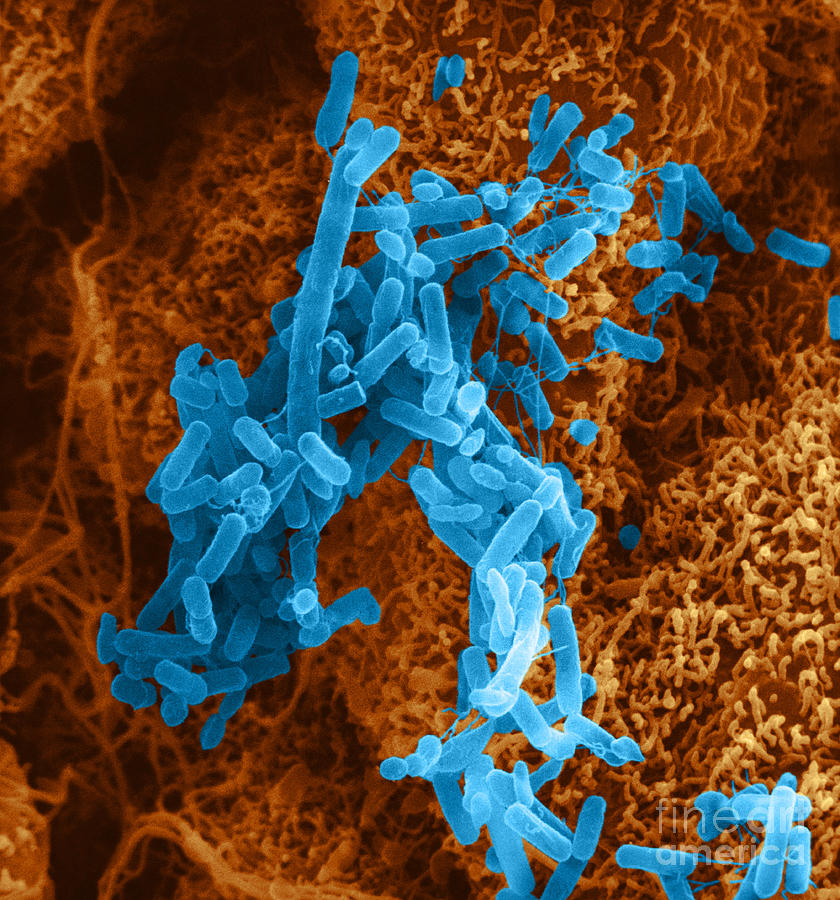 Pseudomonas In Lung Sem Photograph By David M Phillips Pixels