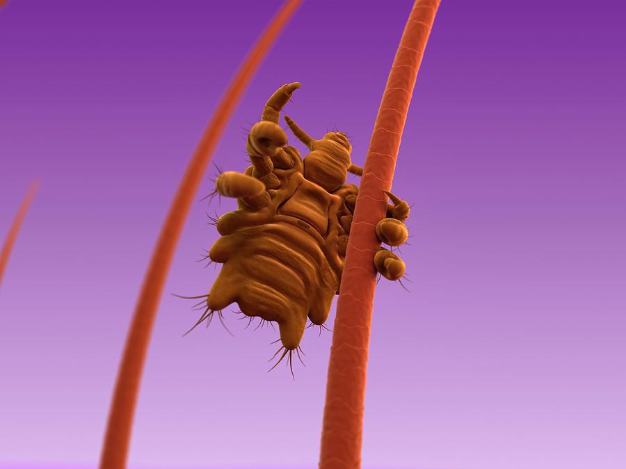 Pubic Louse Photograph By Sciepro Science Photo Library