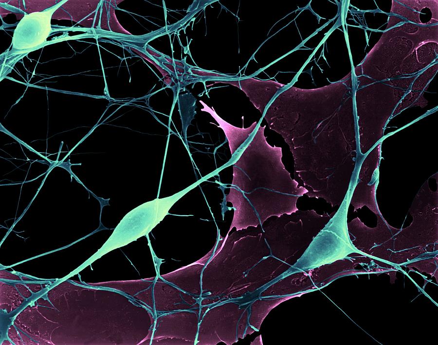 Pyramidal Neurons From Cns #5 Photograph by Dennis Kunkel Microscopy/science Photo Library