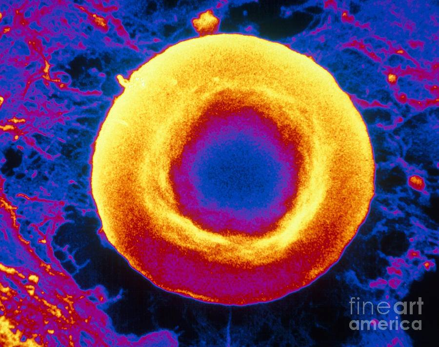Red Blood Cell, Sem #5 Photograph by David M. Phillips