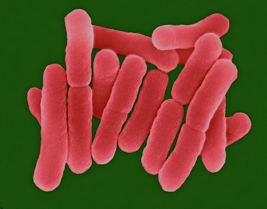 salmonella-typhi-photograph-by-dennis-kunkel-microscopy-science-photo