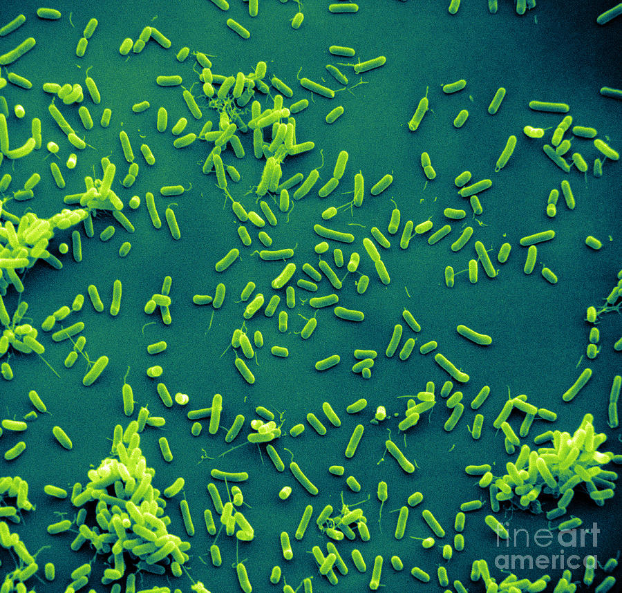 Sem Of Haemophilus Influenzae #5 Photograph by David M. Phillips