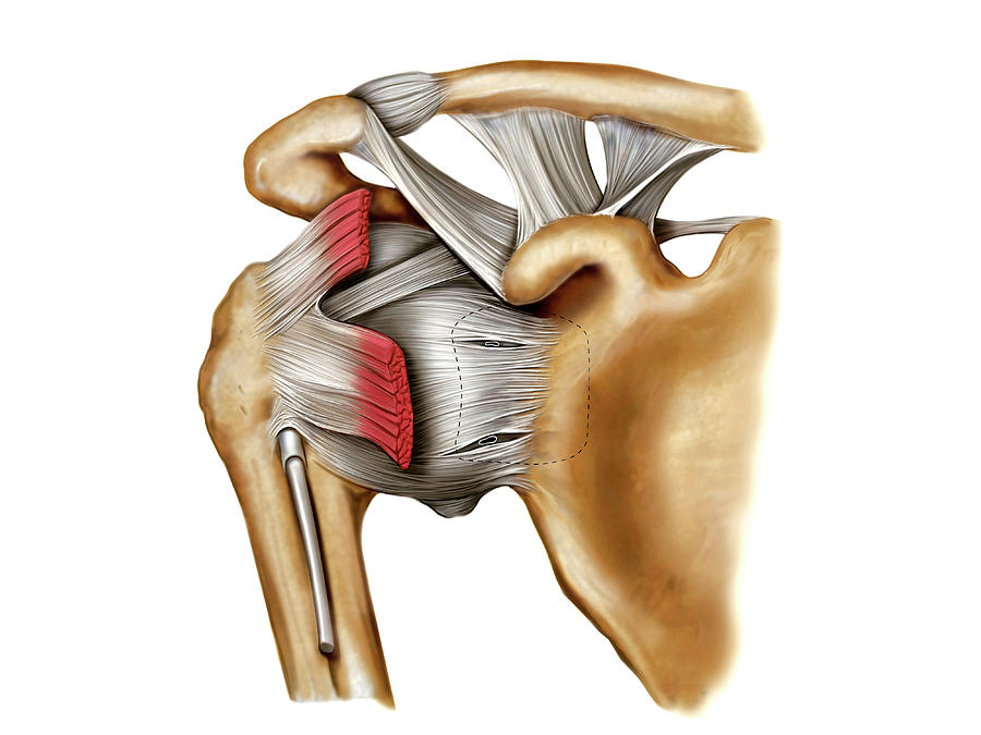 Сустав 5. Shoulder Joint.