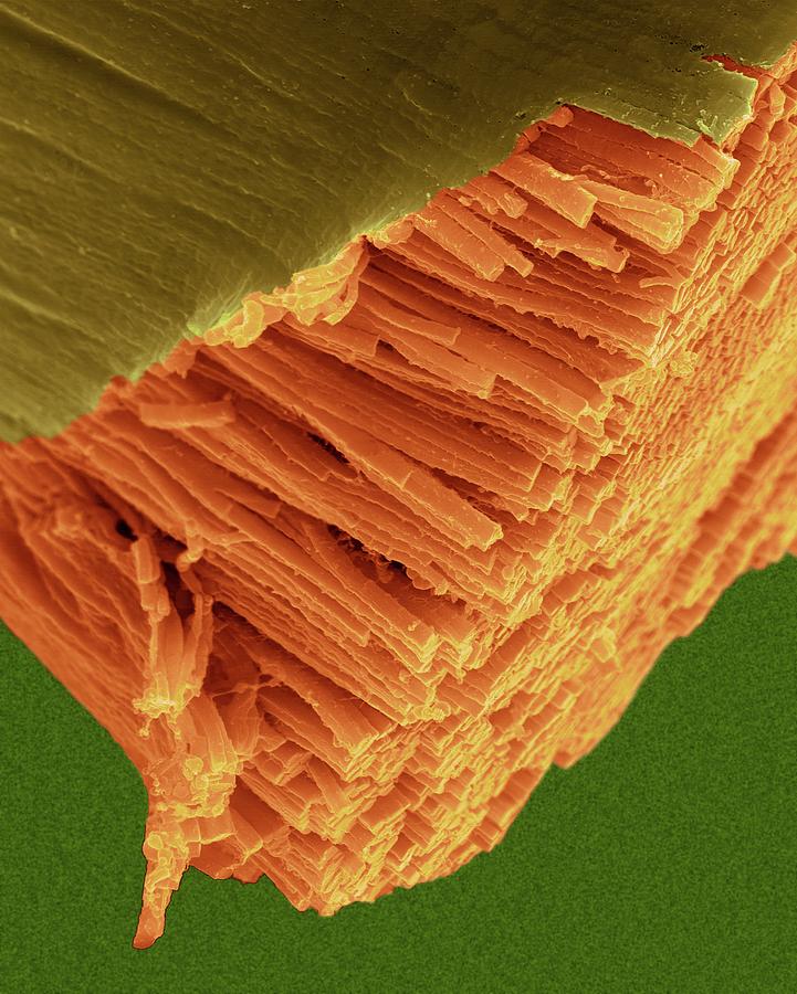 Skeletal Muscle Actin Myosin Filaments #5 Photograph by Dennis Kunkel Microscopy/science Photo Library