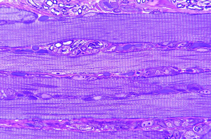 Skeletal Muscle #5 Photograph by Microscape