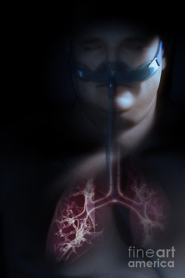 Sleep Apnea #5 Photograph by Science Picture Co