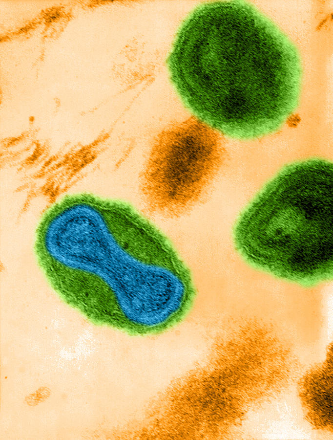 Smallpox Virus, Tem #5 Photograph by Science Source