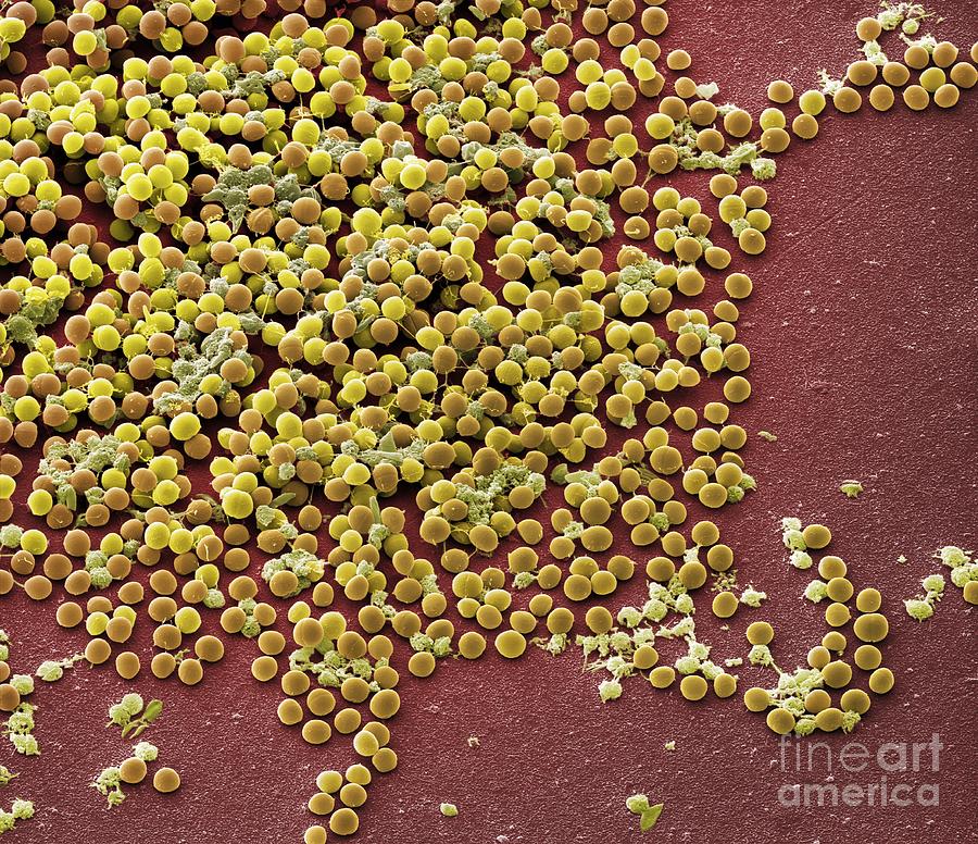 Staphylococcus Aureus Bacteria Sem Photograph By Science Photo Library