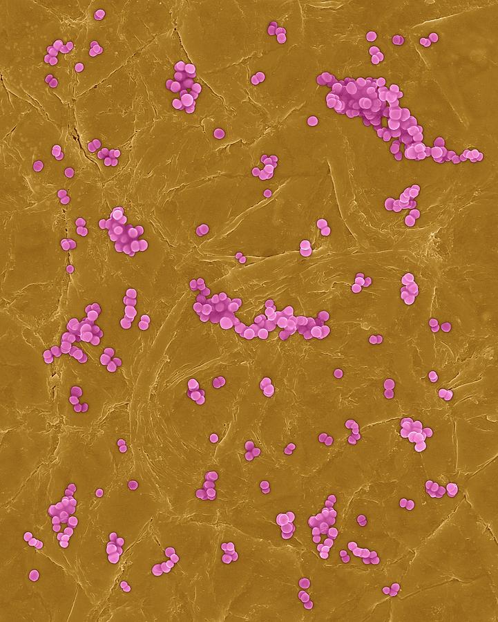 Staphylococcus Aureus On Human Skin Photograph By Dennis Kunkel