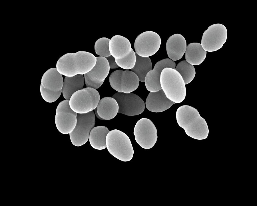 Streptococcus Pneumoniae Photograph By Dennis Kunkel Microscopyscience
