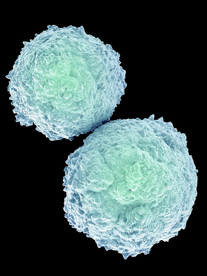 T Lymphocyte Photograph - T-lymphocytes #5 by Maurizio De Angelis