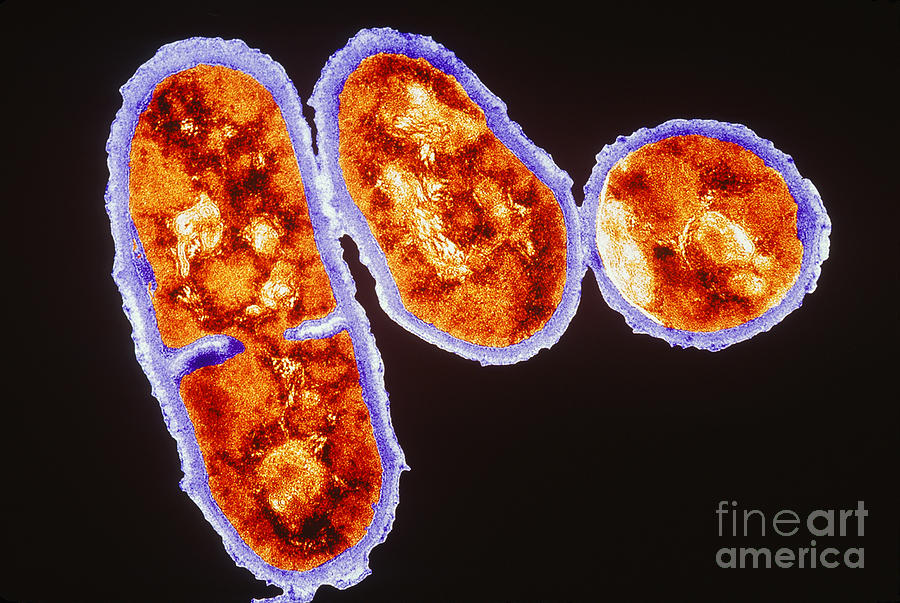 Tem Propionibacterium Acnes #5 Photograph by Kwangshin Kim