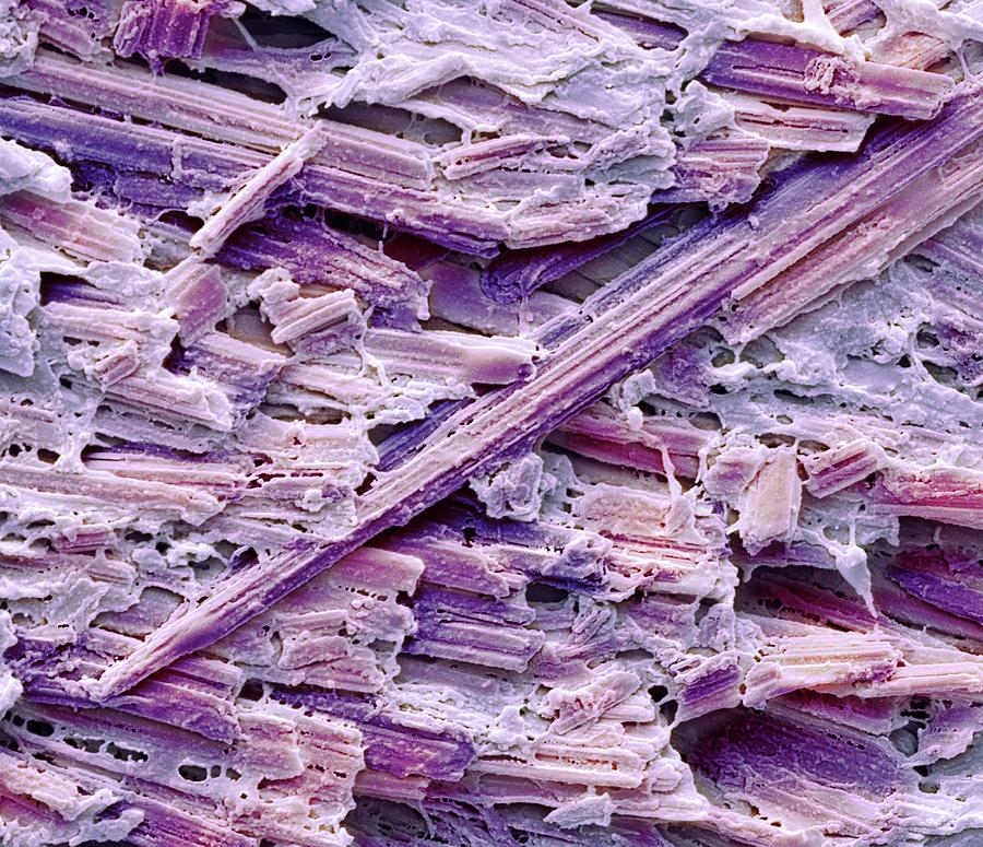Uric Acid Crystals #5 Photograph by Steve Gschmeissner