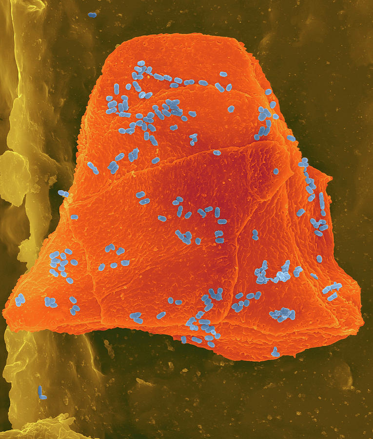 Used Wax Dental Floss #5 Photograph by Dennis Kunkel Microscopy/science Photo Library